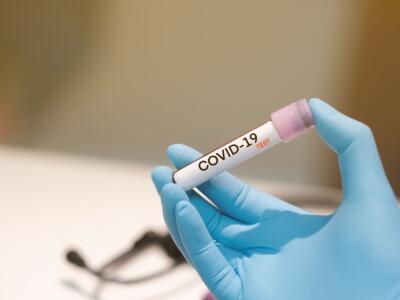 Test per il COVID-19