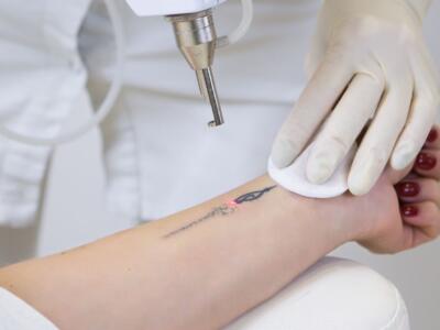 Un tatuaggio medicale