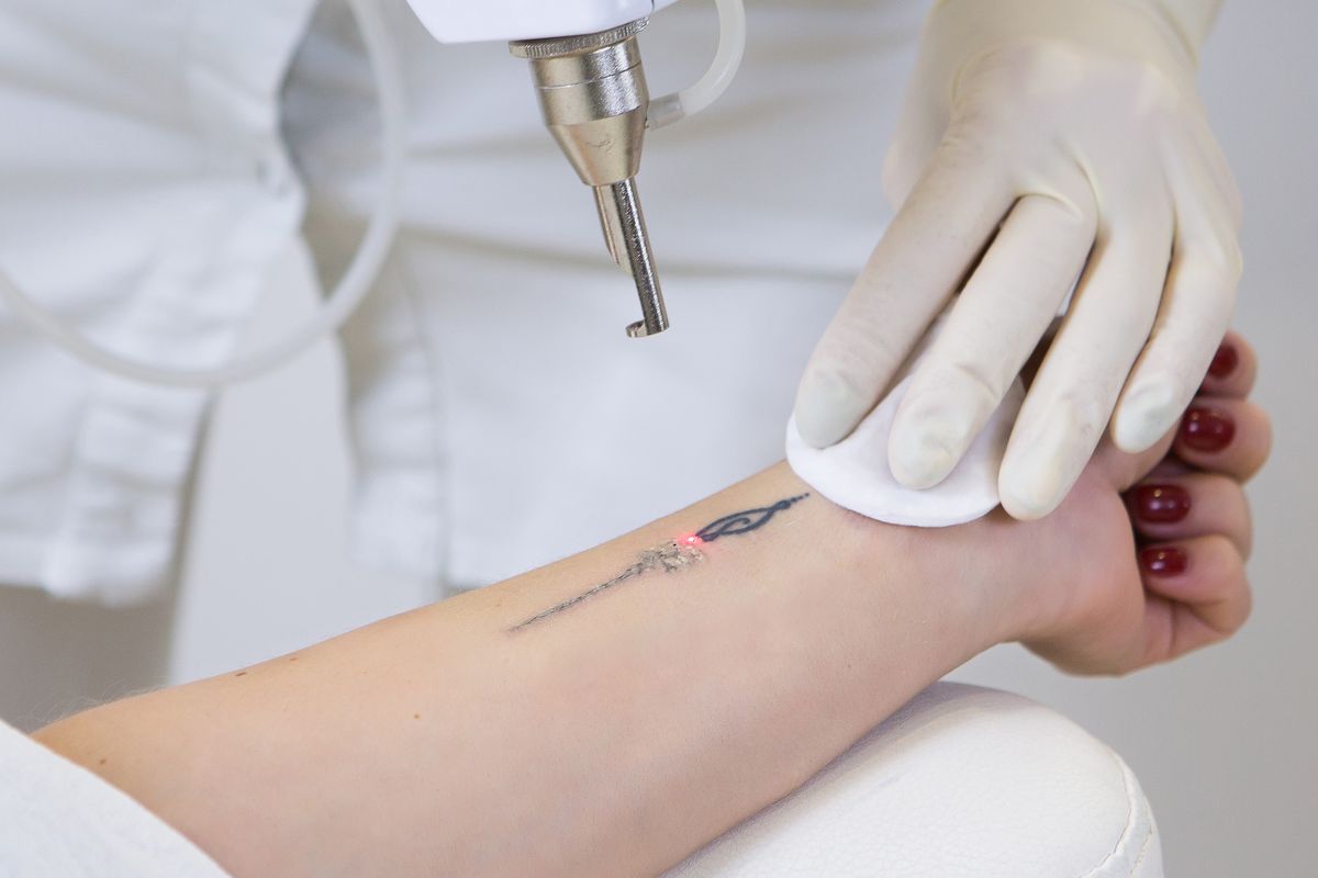 Un tatuaggio medicale