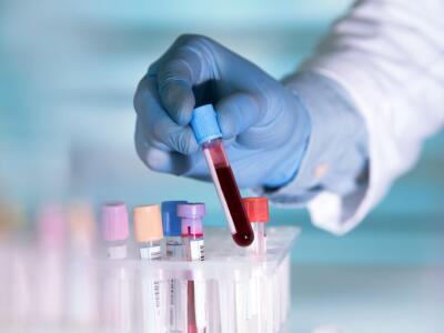provette sangue esami laboratorio analisi prelievo